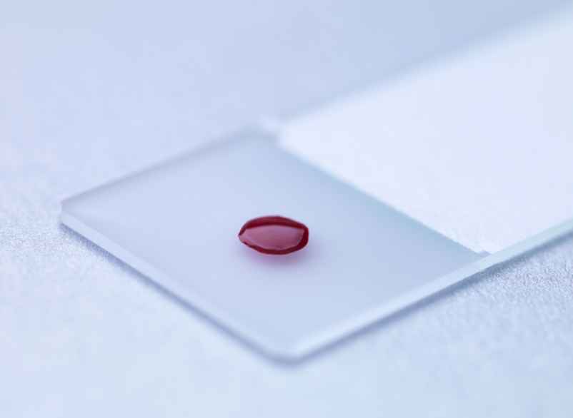 Interprétation conjointe avec les autres leucocytes et globules-France Légumes
